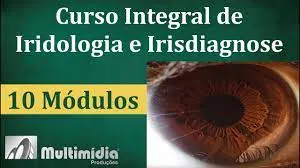 Capa: Download Curso Lyra Trader: Domine Opções Binárias Agora!